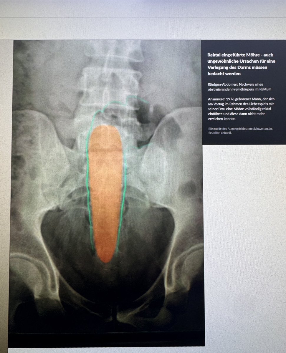 MatFreund's tweet image. sehr nett von fler dass er seinen Fall für Studenten zur Verfügung stellt
