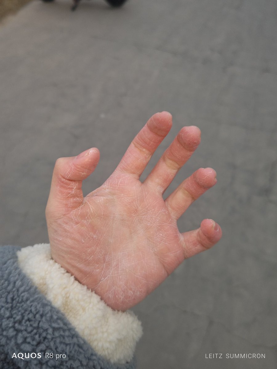 美琴御坂🏳️‍🌈 tweet media