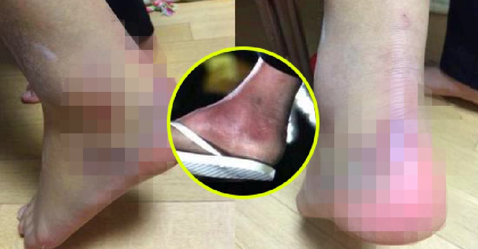 baekcndy's tweet image. pras infelizes burras tonhas apoiando essa tragédia o
com o grupo que dizem amar, mostro aqui um pouco do que os seus idols passam nessa empresa: