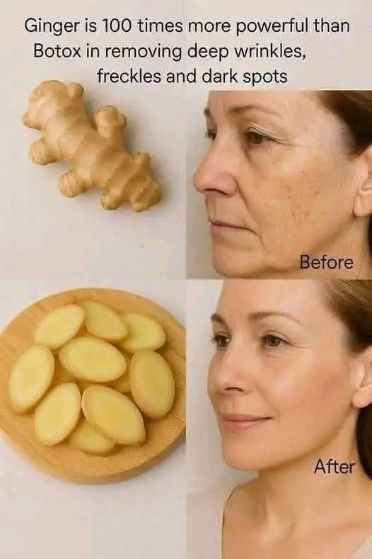 Ginger Glow Remedy: Nature’s Anti-Aging Secret Everyone Is Talking About 🌿✨People are shocked when they learn what ginger can do for skin appearance… 👀👇
🌿 Ginger is rich in antioxidants that support skin renewal
🌿 Helps reduce the appearance of wrinkles &amp; fine lines
🌿