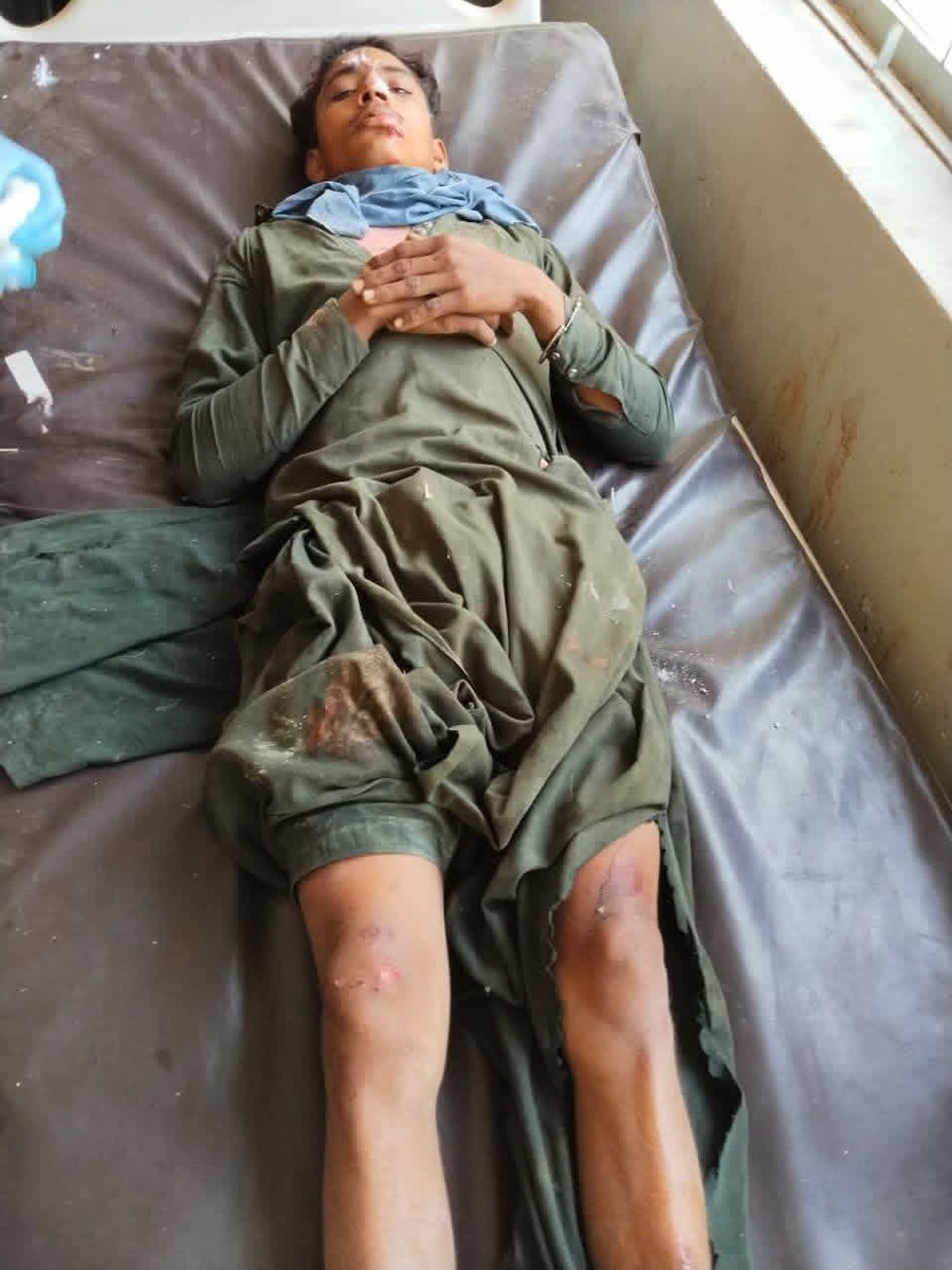 ٽالهي موڙ ڪار ۽ موٽر سائيڪل ۾ ايڪسيڊنٽ .هڪ فوت ٻه زخمي. 
سمجهو زال والو ڪولهي فوت. رميش پٽ مصري ۽ والو پٽ ماليو ڪولهي زخمي. زخمي ۽ فوت ٿيل عورت ڪولهي ذات ۽ لڳ ڳهڳه موري جاٻڌايا وڄن پيا 😭