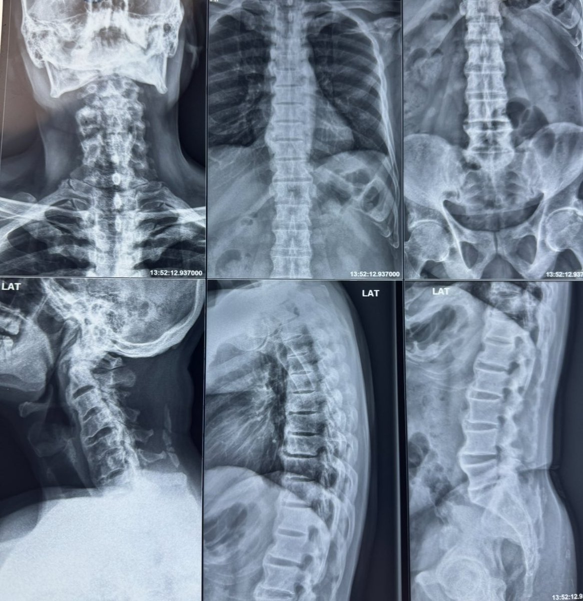 Dr Abhilasha Manwatkar (AIIMS Nagpur) tweet media