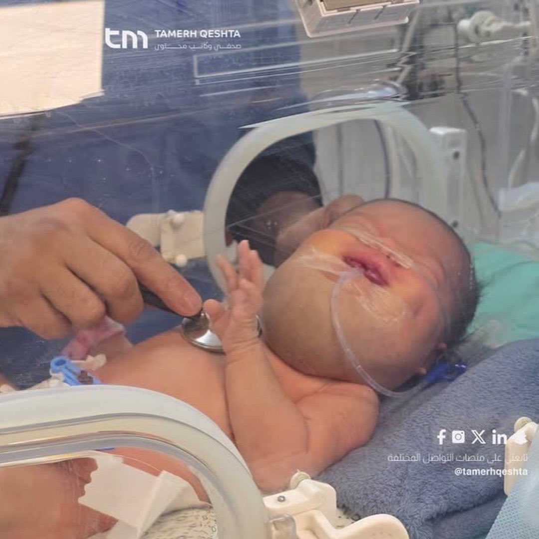 EyeonPalestine's tweet photo. The infant Du'a Qashta, only weeks old, is currently in the neonatal intensive care unit at Nasser Hospital. She is suffering from a tumor in her throat that poses a serious threat to her life.
She urgently needs an immediate medical referral abroad to receive proper treatment. https://t.co/hh11DloXKv