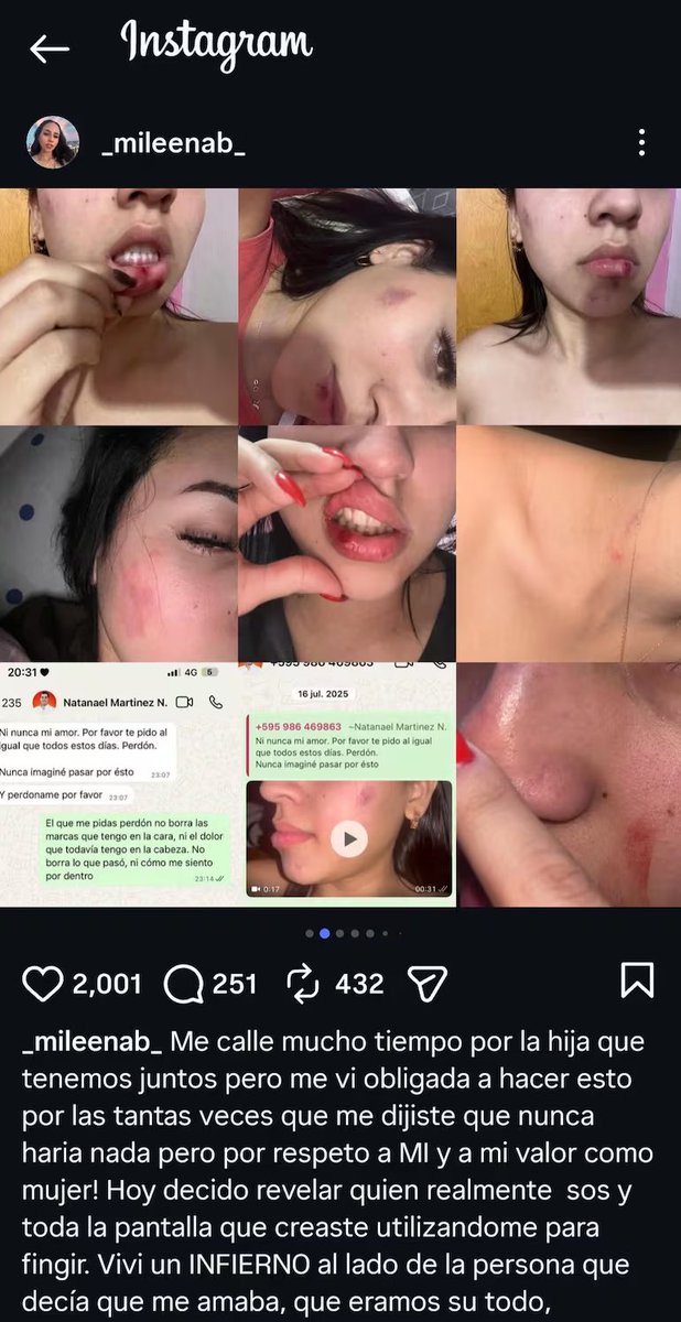 delpynews's tweet photo. ▶️DENUNCIÓ A PRECANDIDATO A INTENDENTE DE YPANÉ POR VIOLENCIA | ​🔴

🛑​Milena Páez, expareja del político Natanael Martínez, publicó imágenes de sus heridas y realizó un fuerte descargo en redes sociales sobre las agresiones. 

"Hoy decido revelar quién realmente sos y toda la pantalla que creaste utilizándome para fingir (...) Viví un infierno al lado de la persona que decía que me amaba (...) Rompemos el patrón o el patrón nos rompe a nosotras”, expresó.

Vía: ABC Color