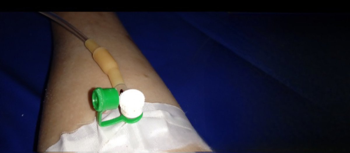 MaryaminGaza's tweet photo. 😔💔I repeat my plea, my heart filled with hope. My sister is still suffering after her painful fall and the resulting brain hemorrhage caused by fever and her weakened body. Her immune system, already depleted by the war, is no longer strong enough to fight on its own.

We are still searching for someone to help us secure the cost of her treatment and some essential fruits to replenish her lost blood. Watching her wither away before our eyes is devastating for us as a family.
[ https://t.co/61trVhYIGE]
Please help us, even by sharing this post, so our voice reaches compassionate hearts capable of offering support. May God reward you.
