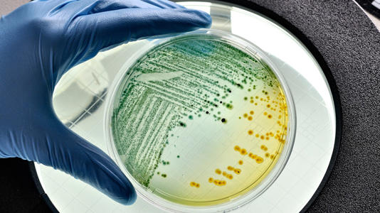 TheUAPMinute's tweet photo. 🧬🛰️ Space station microbes may offer a new weapon against drug-resistant superbugs

Researchers studying bacteriophages — viruses that infect bacteria — on the ISS found that microgravity nudges evolution in unusual directions. Phages exposed to space conditions developed mutations that made them better at attacking certain bacterial strains back on Earth, including some that are notoriously hard to treat.

Why it’s promising:
• microgravity creates evolutionary pathways we don’t see on Earth
• some space-shaped phages showed enhanced bacteria-killing ability
• antibiotic resistance is a major global crisis with few new drugs in the pipeline

It’s early science, but it suggests space could become a biotech testbed, not just a physics lab — and that outsmarting superbugs might require thinking beyond the planet that created them.