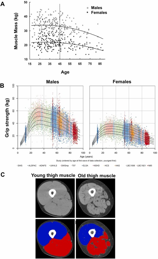 a_garciahermoso's tweet image. Desde la mediana edad perdemos masa y fuerza muscular. A los 85 años, la pérdida puede rondar el 25% respecto a los 45, y además baja la “calidad” del músculo (más grasa infiltrada).

👉 Mantener la #fuerza es clave para un envejecimiento saludable.

sciencedirect.com/science/articl…