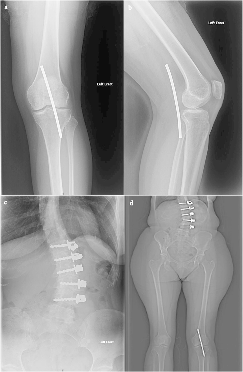 J Bone & Joint Surg tweet media