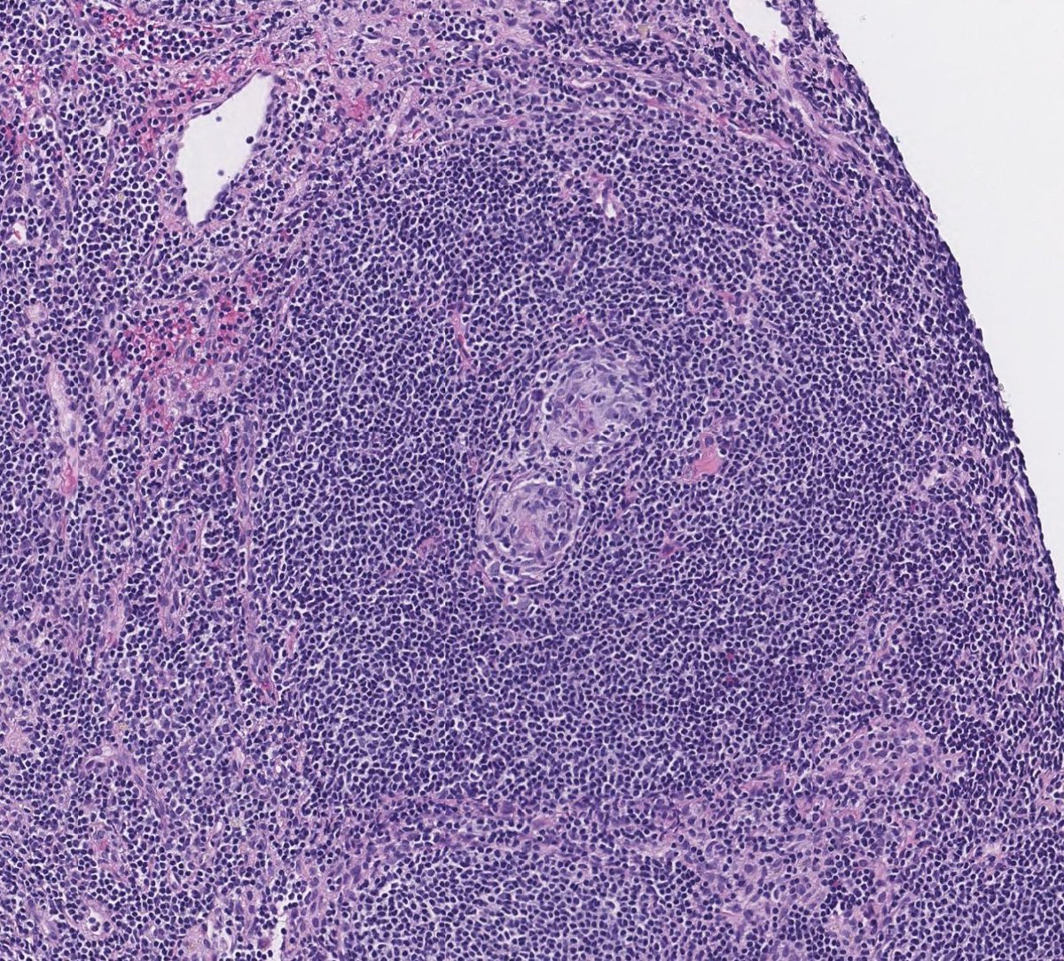 Toby Schmitt, MD tweet media