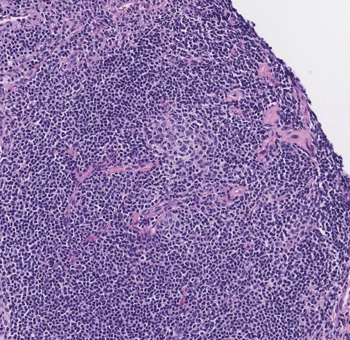 Toby Schmitt, MD tweet media