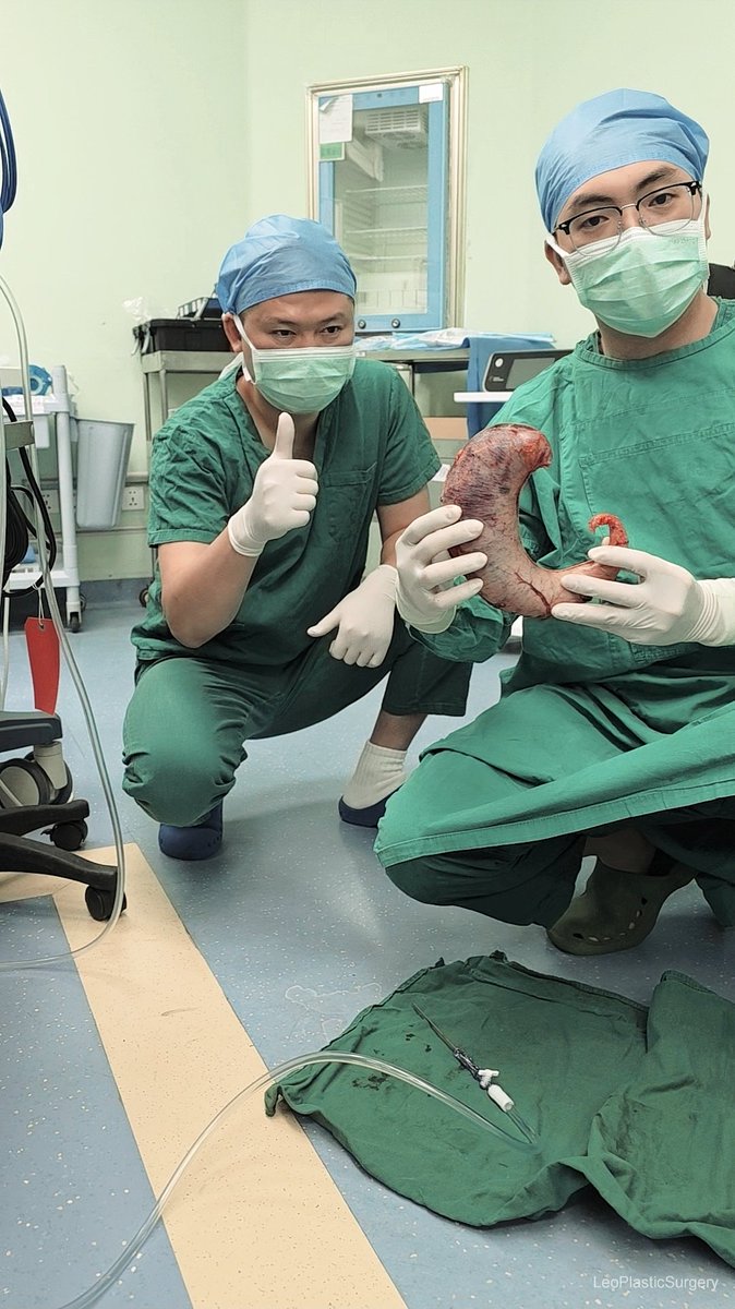 DrLeoSurgery's tweet photo. Leou International Medical Aesthetic Group, in collaboration with a leading tertiary hospital surgical team in China, has successfully completed a minimally invasive metabolic weight-loss procedure.
Through comprehensive preoperative assessment and precise laparoscopic techniques, the surgery was performed safely and smoothly, with stable recovery and minimal physical burden to the patient.
This collaboration reflects not only advanced surgical expertise, but also a shared commitment to medical ethics, patient-centered care, and cross-border professional cooperation.
Looking ahead, we remain dedicated to advancing precision medicine and contributing to global health through responsible, evidence-based medical practice.
#胃切除VSGBeforeAfter#GastricSleeveAsian#Asiangastricsleevebeforeandafter#袖状胃减重前后照片