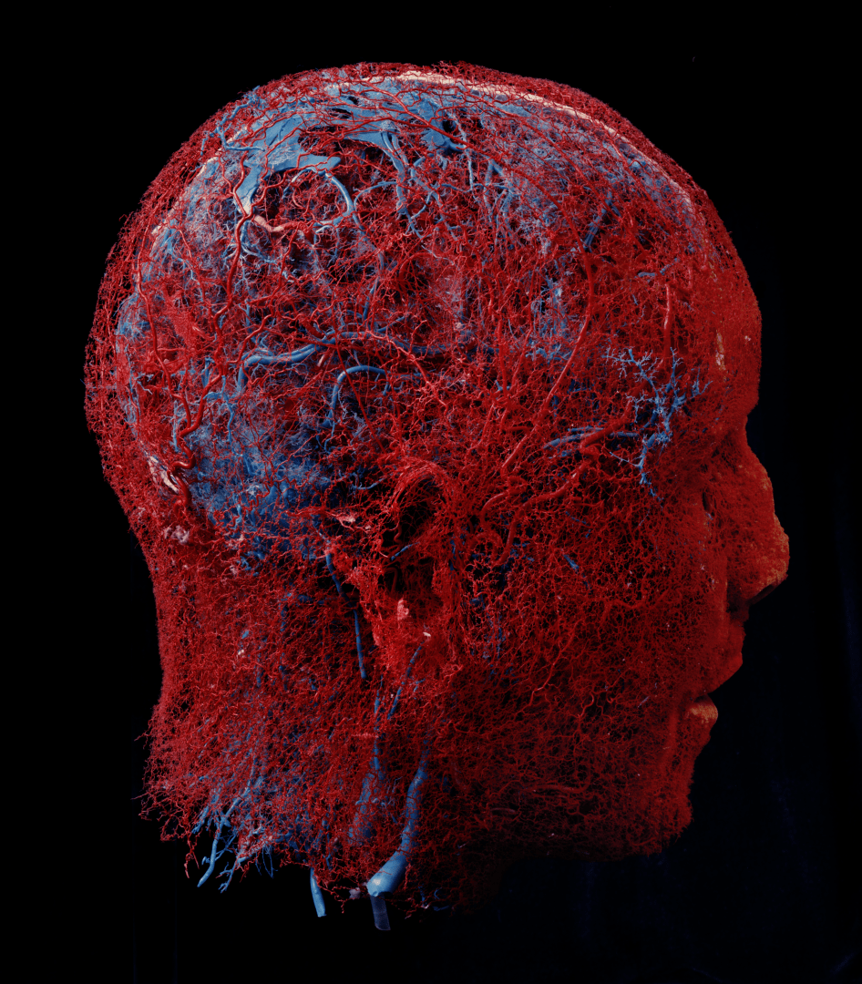BigBangSciCom's tweet photo. Les vaisseaux et capillaires sanguins de la tête, mis en évidence grâce à la technique de plastination

Crédits : Jack Burman

#Médecine #Anatomie #Medicine #Anatomy #HumanBody #CorpsHumain #Biologie #Biology #SVT https://t.co/E6HMYgDRyF