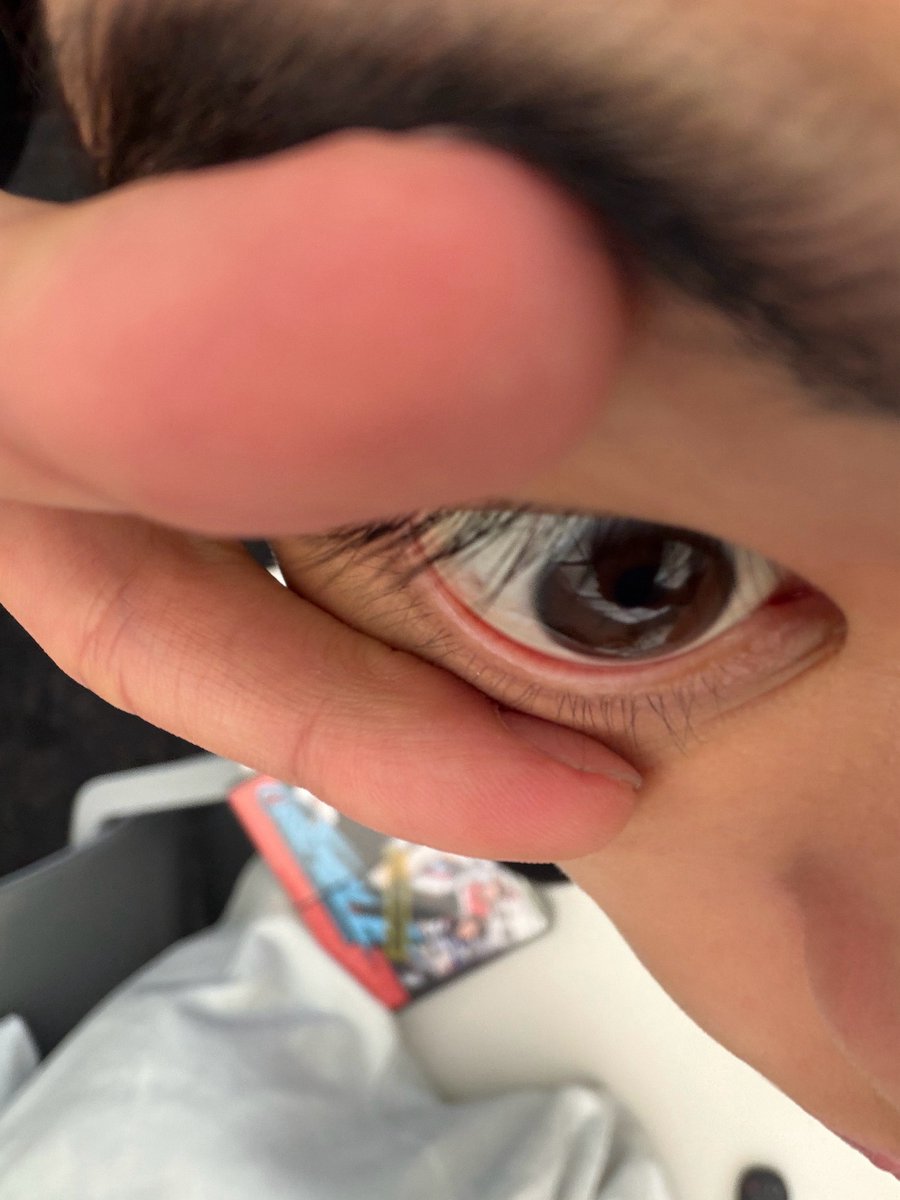 근데 이게 ㅈㅉ 진짜겟죠.... 
아 이 똥강아지 ㅈㅉ 기엽다ㅏ😭😭