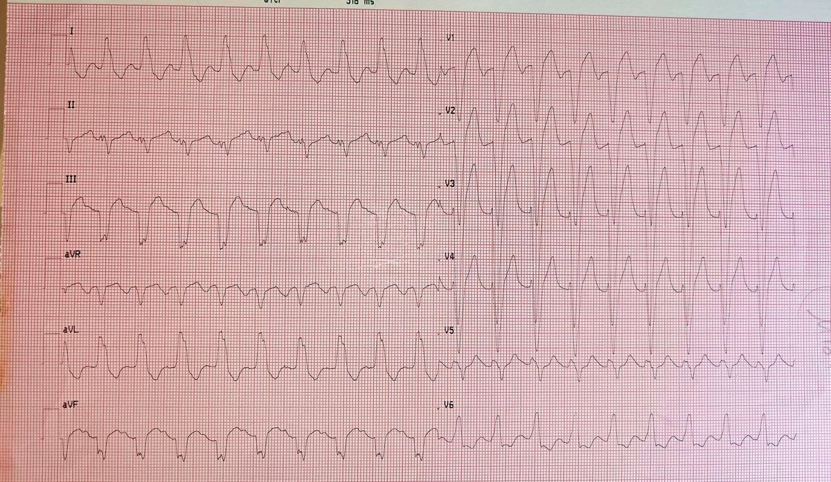 What is the rythm ⁉️