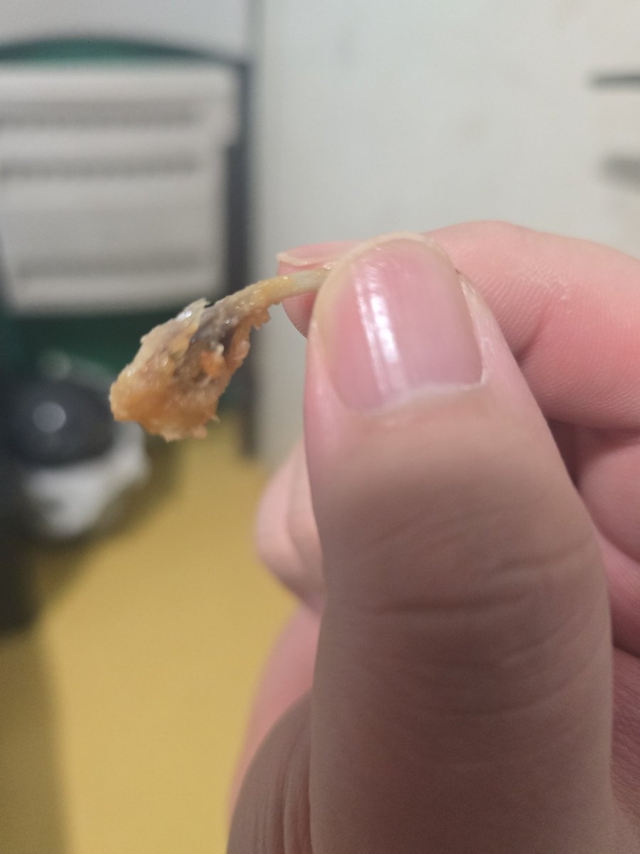 순살치킨을 시켰는데 뼈가 나옴