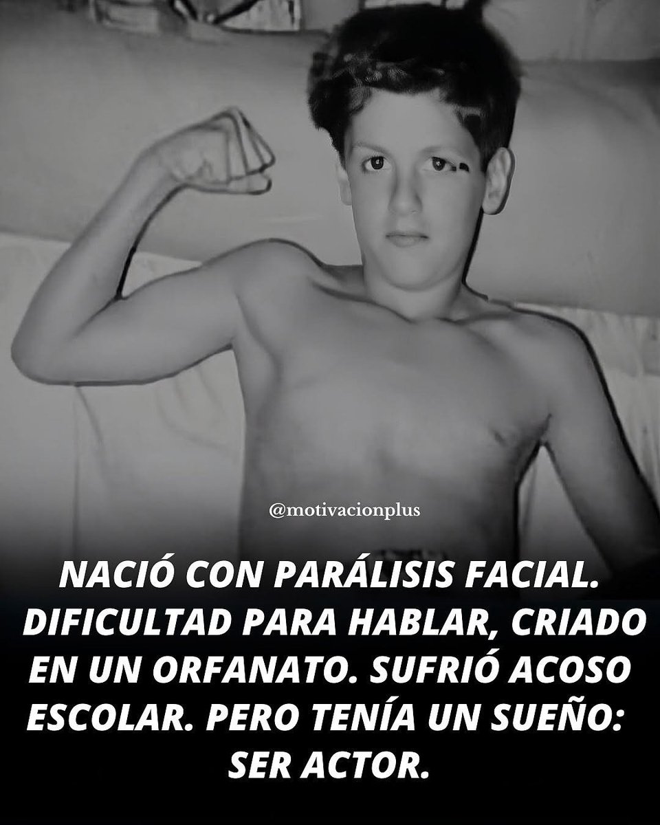 Nacio con paralisis Facial, dificultad para hablar y criado en un orfanato.  

Pero tenia una sueño que cumplio ser Actor...  

//Hilo//