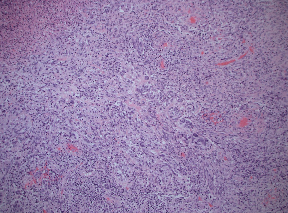 Dan Graham tweet media