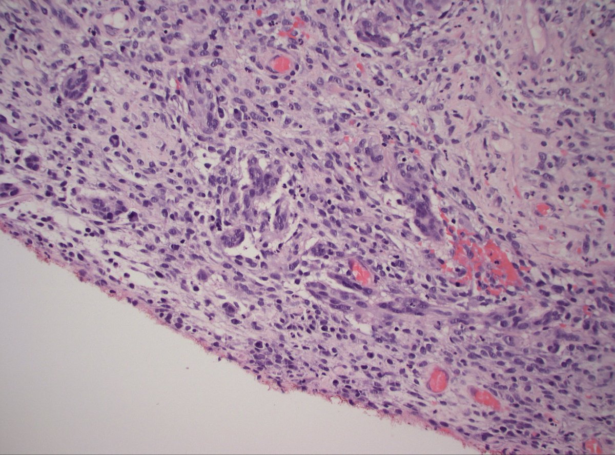 Dan Graham tweet media