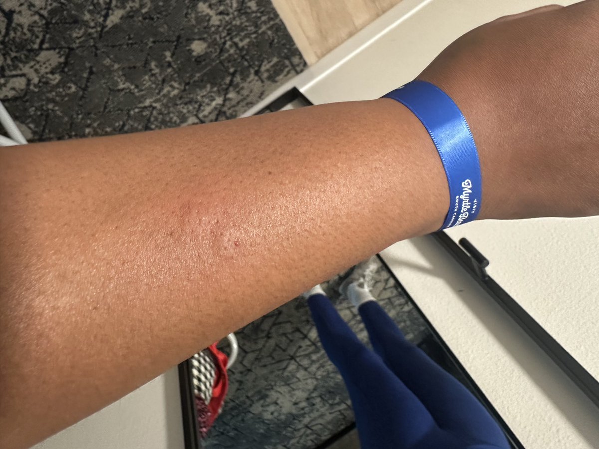 Pretti_Gyrlz's tweet photo. Visited @sheratonhotels  in Myrtle Beach and was bite. They don’t want people to know this and trying to keep me hush hush saying it was in the air. How TF is this even possible. Laid down without bites wake up with bites. Make it make sense. What do you call this ish? https://t.co/qU4q03DgJe