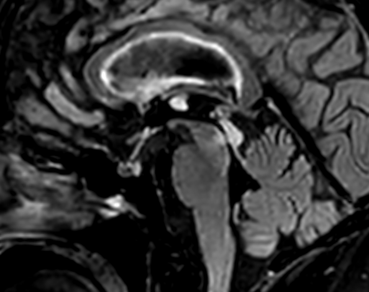 Jack Garnham tweet media