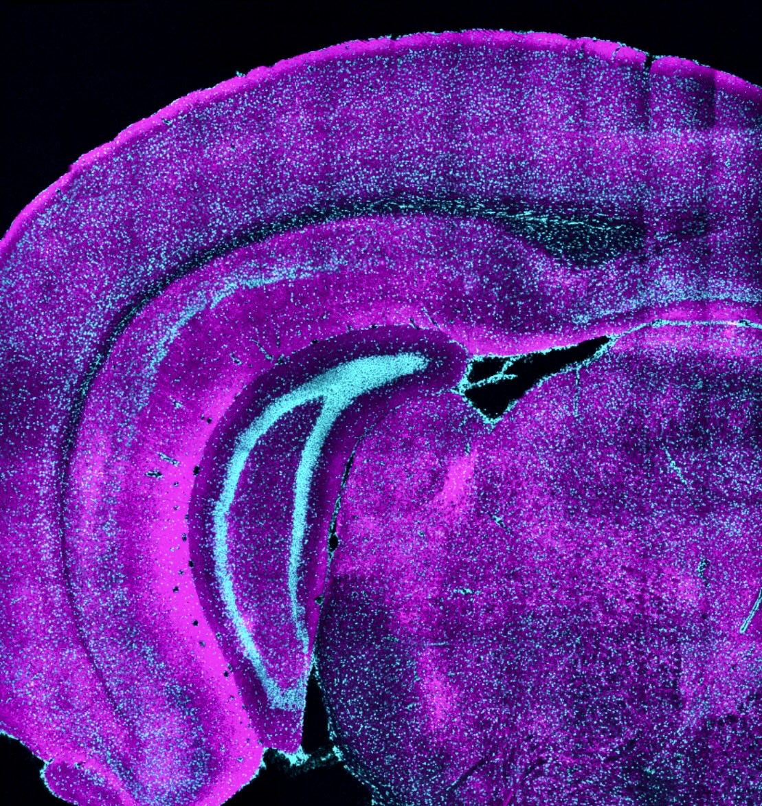 🧠 How a unique class of neurons may set the table for brain development

A new MIT study finds that somatostatin-expressing neurons follow a unique trajectory when forming connections in the brain’s #visual #cortex that may help establish the conditions needed for sensory