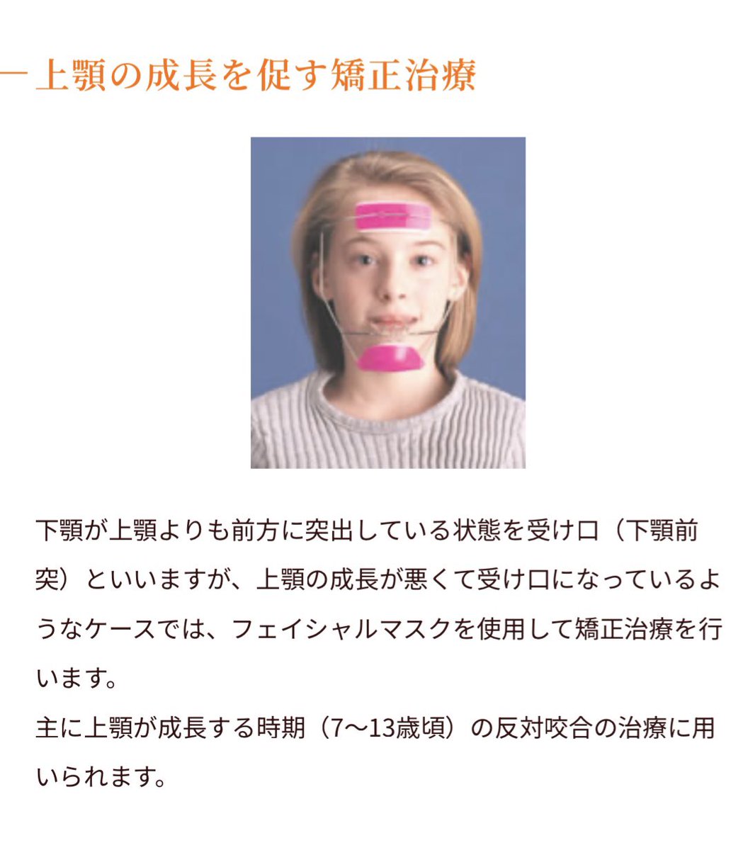 ococoo_c's tweet image. 多分気休めで矯正でもできる治療が無いからなんだろうけどフェイスマスクを渡されている。
少しでも後戻りするようにと。
これをつけてる自分がばかばかしくて、泣けてくる😢そもそも何もしなくても痛過ぎてしんどいのに付けられないよ…