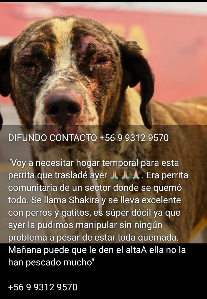 #IncendiosForestales 
#Incendios 
Hogar temporal para ella porfa , es comunitaria y está quemada , la darán de alta y necesita un lugar seguro para recuperarse 😞😞😞