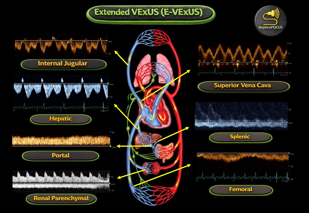 NephroPOCUS tweet media