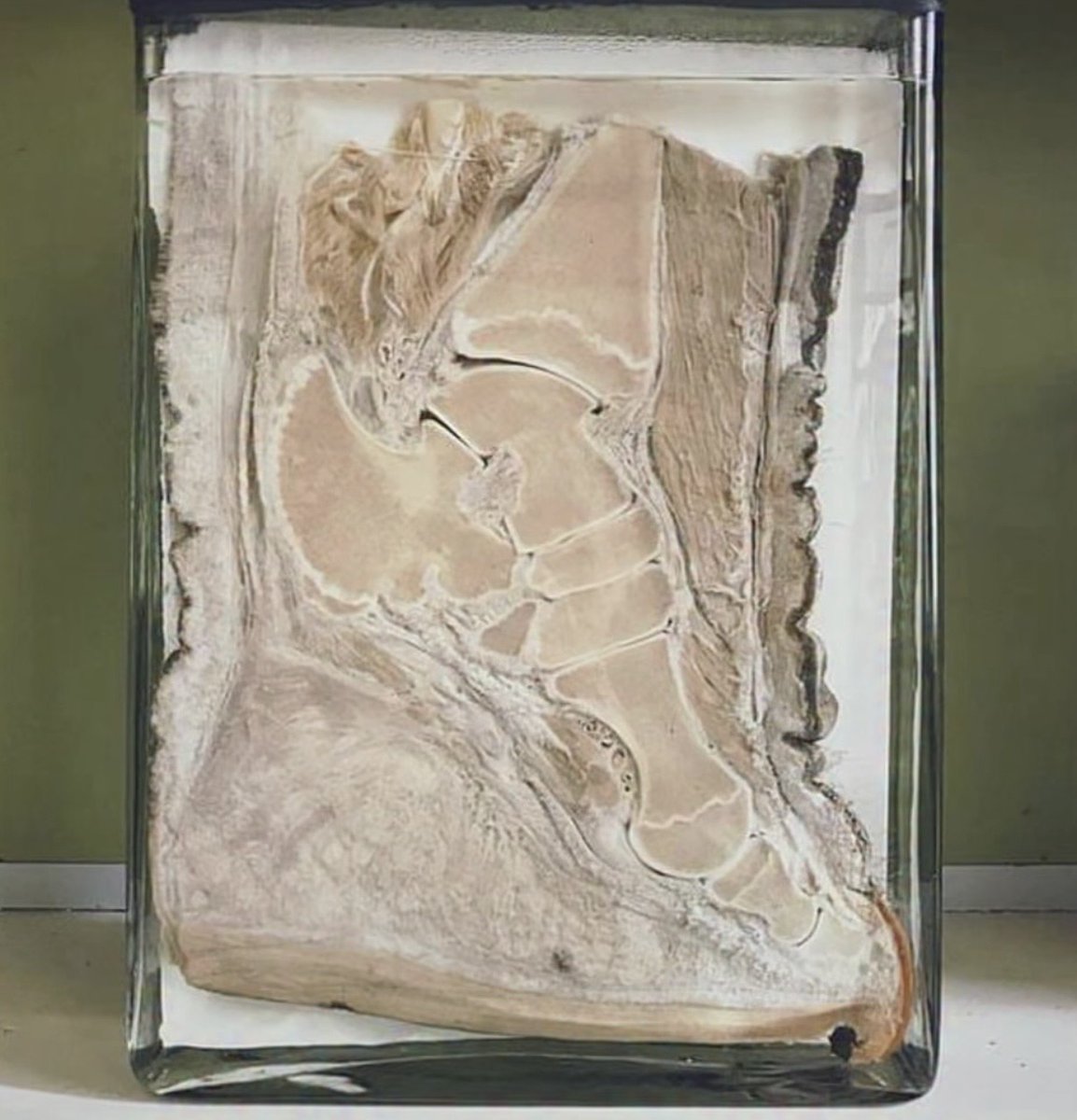 historyinmemes's tweet image. A cross-section of an elephant’s foot reveals a structure similar to a human foot, but with a large, thick fatty pad beneath the heel.