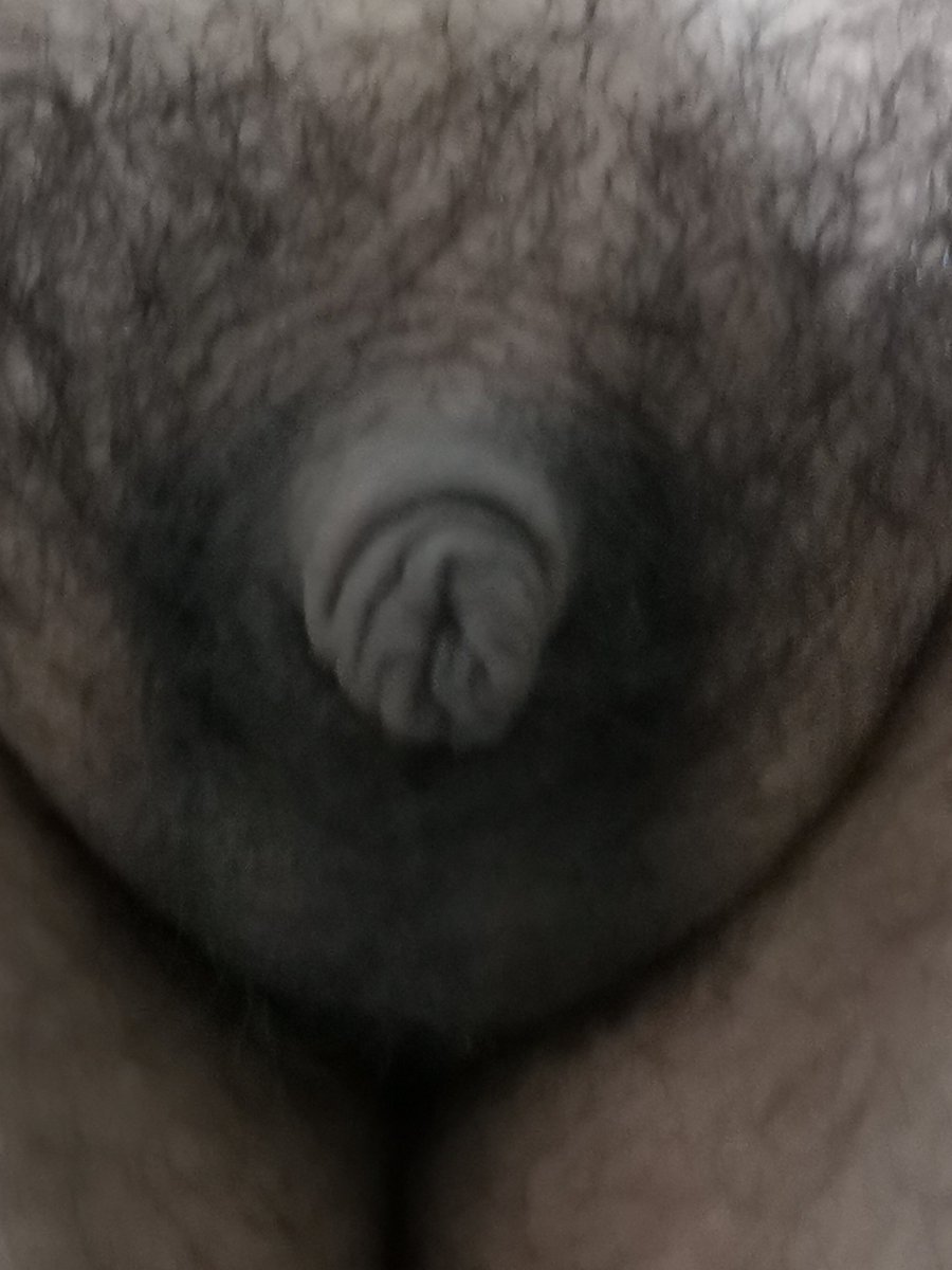 Small Dick World tweet media