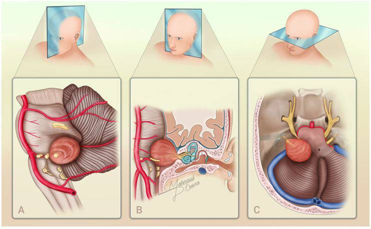 Journal of Neuro-Oncology tweet media
