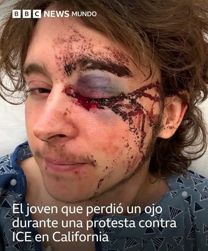 📰 BBC: «Kaden Rummler dice que protestar por la muerte de una mujer a manos de un agente del ICE casi le cuesta la vida. El joven de 21 años participaba en la tarde-noche del pasado viernes en una manifestación frente a un edificio federal en Santa Ana (California)»