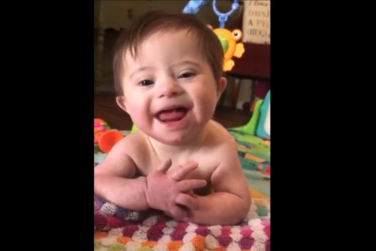 LifeNewsHQ's tweet photo. Iceland and Denmark Have Killed Nearly Everyone With Down Syndrome. This is Eugenics https://t.co/91J9ypPRfQ https://t.co/OM3TEWqMJG