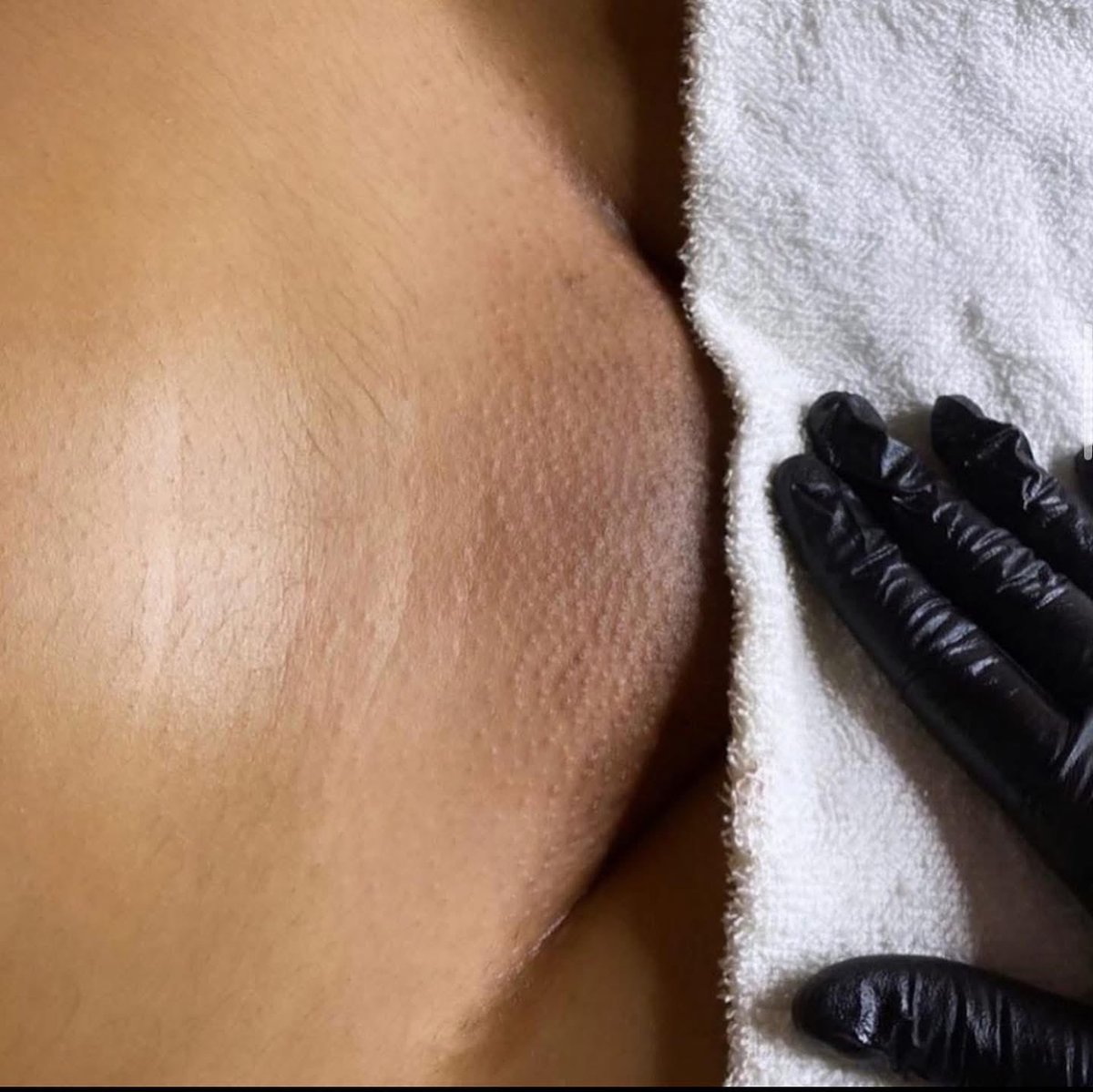 Smooth is a lifestyle.

Waxing all week in Atlanta — for those who like their skin clean, confident, and camera-ready.

Book your appointment or DM to secure your spot.

#AtlantaWaxing #SmoothSkin