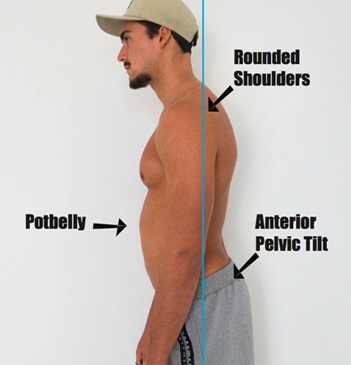 _beercel's tweet image. fuck my stupid pectus excavatumcel life