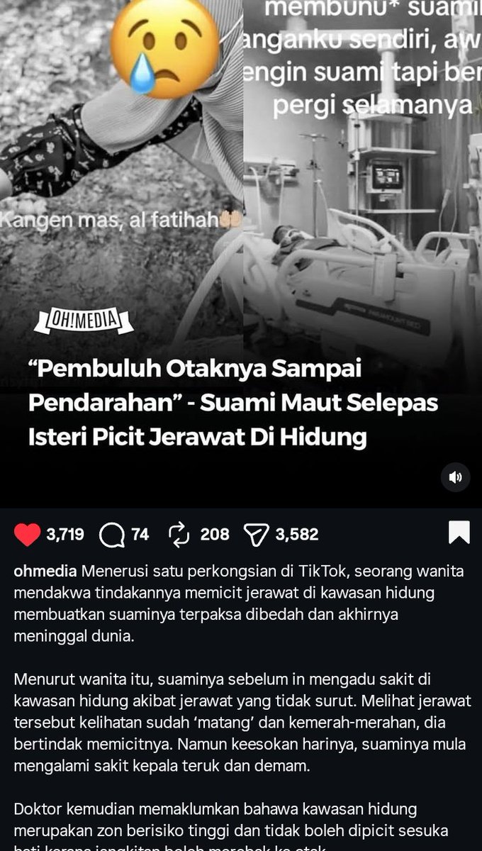 faezahsaad's tweet image. Please ambil pengajaran ya 😥 Jangan sesekali picit jerawat di area hidung anda , tersangatlah bahaya 🤧

Credit : Threads