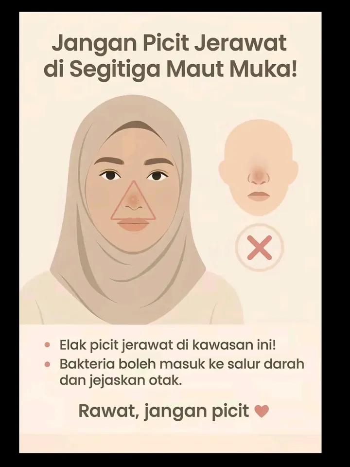 Please ambil pengajaran ya 😥 Jangan sesekali picit jerawat di area hidung anda , tersangatlah bahaya 🤧

Credit : Threads