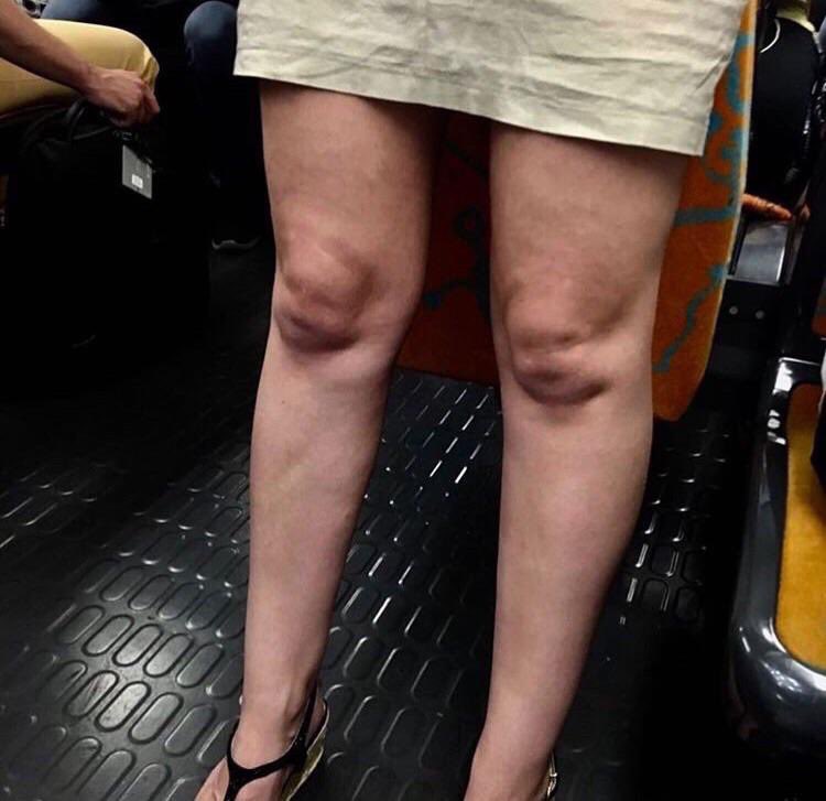 TheWapplehouse's tweet image. There’s an insane subreddit called r/babiestrappedinknees and it’s exactly what it sounds like and now I can’t stop looking at peoples knees for babies