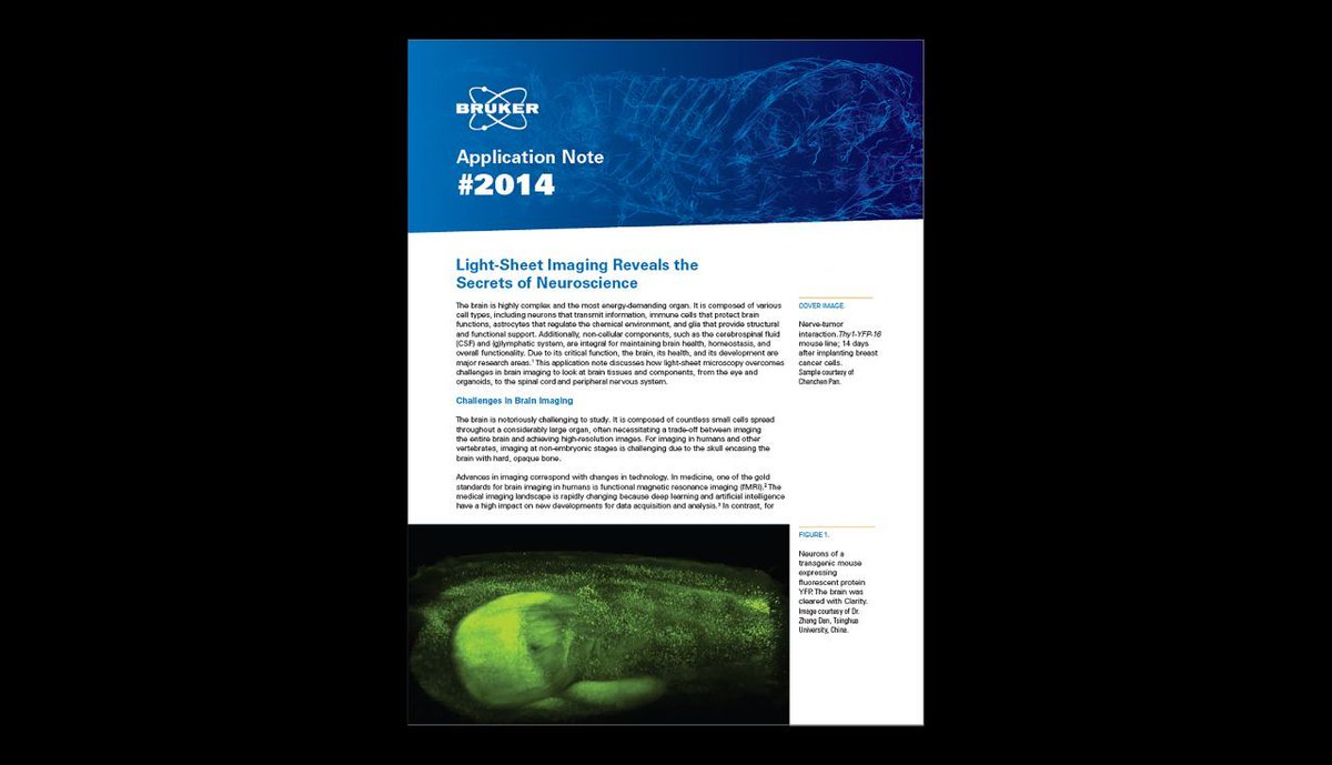 luxendo's tweet photo. 🧠 Working in Neuroscience?
Then this application note is for you!

"Light-Sheet Imaging Reveals the Secrets of Neuroscience"
 
Read more: https://t.co/Obn2oVUgbH 
#science #research #spim #neuroscience https://t.co/zRClkeTeZZ