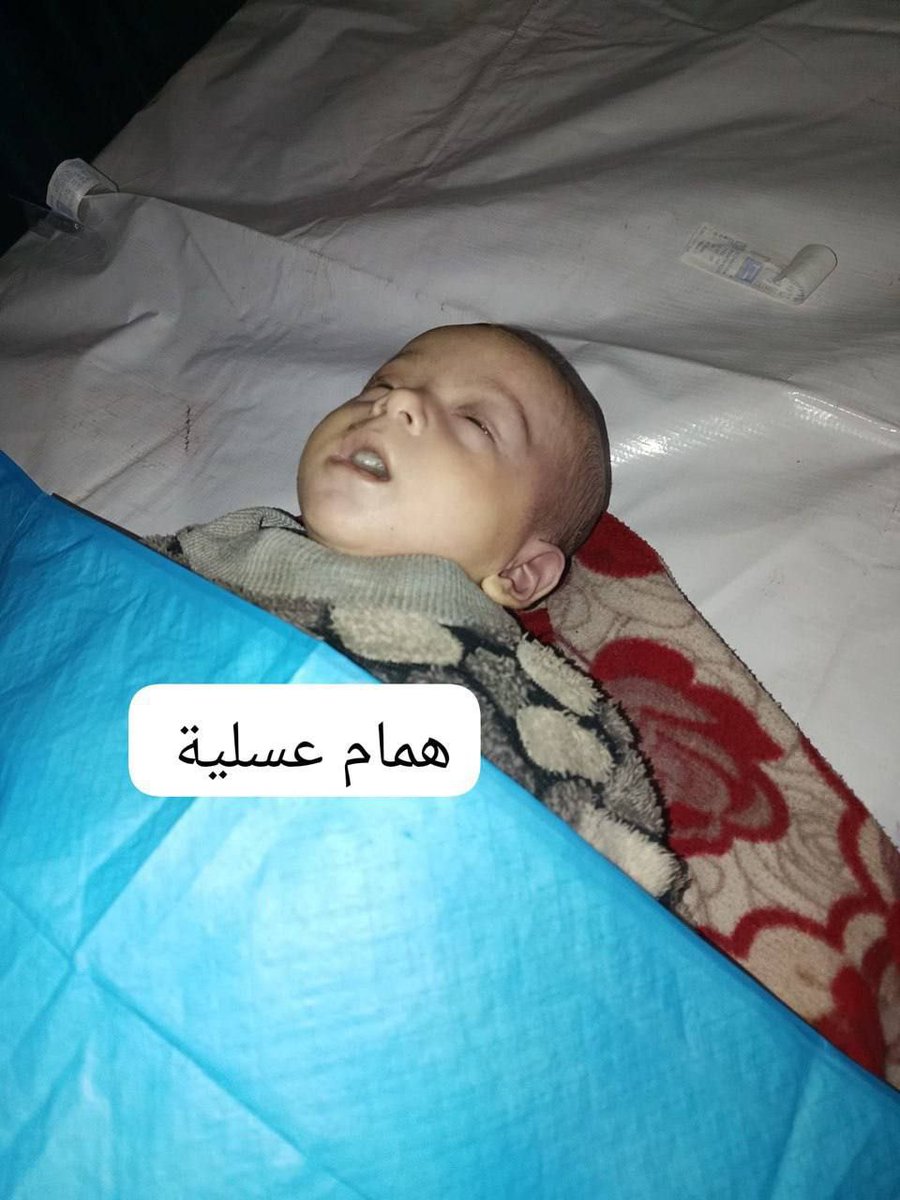 TERKINI 

AL FATIHAH

Seorang bayi perempuan bernama Shatha Abu Jarad meninggal sebentar tadi kerana kesejukan di Gaza 

Jurucakap Pasukan Pertahanan Awam Gaza, Mahmoud Basal menyatakan memang malam tadi cuaca sangat sejuk lebih dari kebiasannya