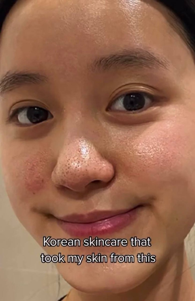 nrlnadiah__'s tweet image. Haritu I share pasal power gila produk korea ni dari skin dia obvious ada large pores dengan blackhead kat hidung boleh smooth licin gitu. 

I TRY WEHHHH!!!! MENJADIII 😭😭