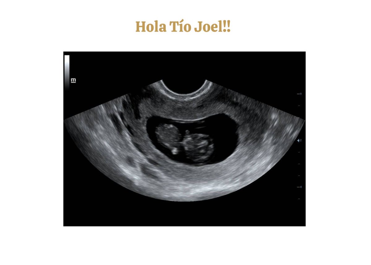 JoelVarper's tweet photo. Una nueva bendición en camino ✨ https://t.co/HLKtaSZlc9