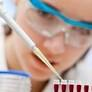 Chemistryaward's tweet image. Plasma protein profiling can help detect cancer in patients with non-specific symptoms
More Information: research-chemistry.blogspot.com
#sciencefather #researchchemistry #biochemistry #scientist #professor #phd #awards #tags #science