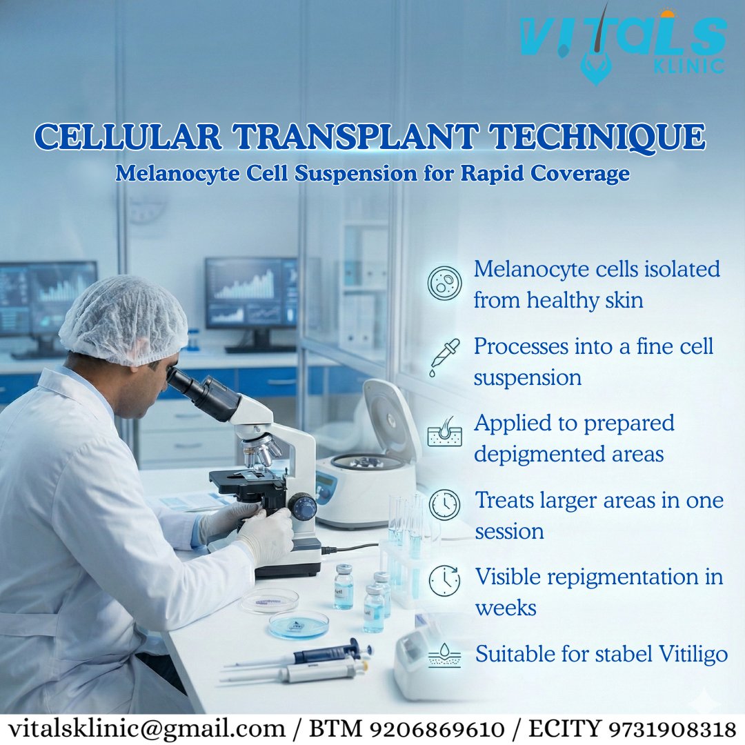 KlinicVitals's tweet image. Vitiligo surgery isn’t about speed.
It’s about stability, selection, and precision.
Right timing makes all the difference.

#vitiligosurgery #dermatology #repigmentation #vitalsklinic