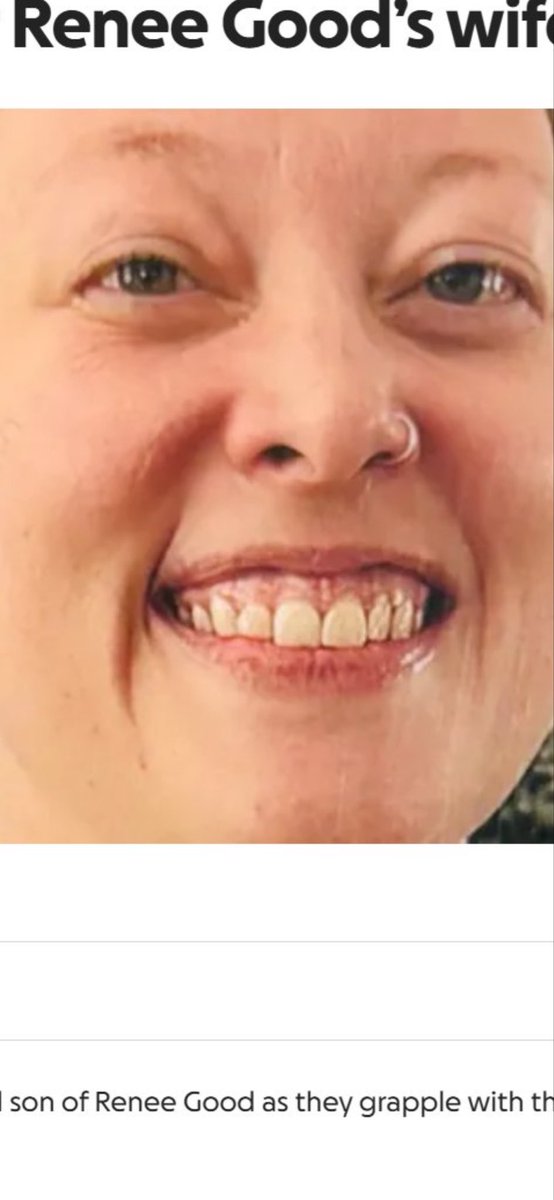 The most ironic part is they ended up having to cry for someone with gumlines higher than Charlie Kirk 🤭