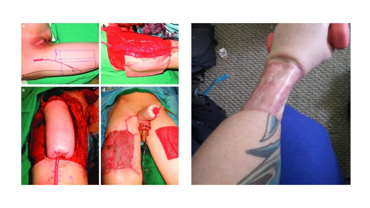 Lo que sí existe es una ideología dañina que infunde mentiras entre las y los menores y les induce a la destrucción de su salud para toda la vida, el transgenerismo, muy bien financiado por las corporaciones médico-farmacéuticas transhumanistas. 
Esto no son Derechos Humanos: