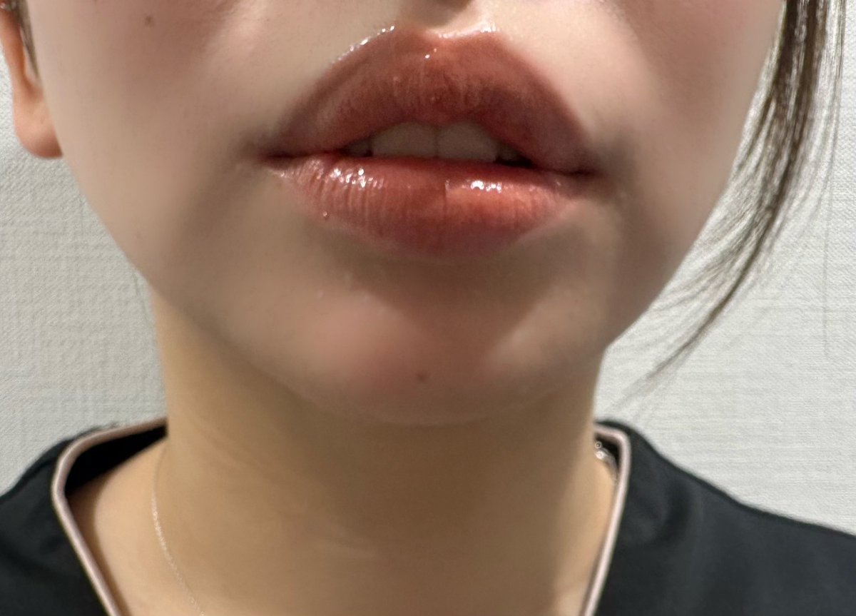 あおちゃんぺ🐯🍼 (@aochanp) / Posts / X