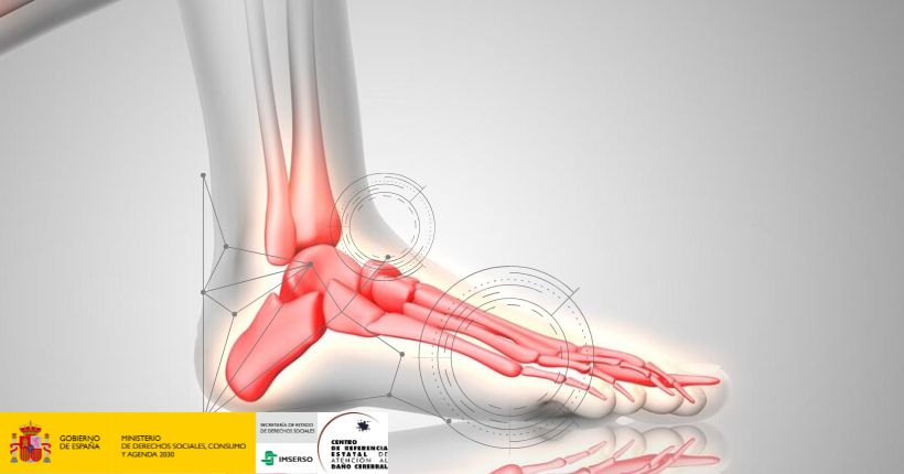 CreCeadac's tweet image. 💻Hoy en el #BlogCeadac compartimos el artículo:

Entrenamiento robótico para la rehabilitación del tobillo en pacientes con ictus y pie caído: optimización de la intensidad y la frecuencia.

🔗Más información: acortar.link/NVhJGC