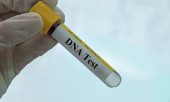 The trending discussion about DNA testing after birth highlights deeper questions about trust, honesty, and cultural expectations in relationships. It’s worth exploring how couples navigate these sensitive topics.