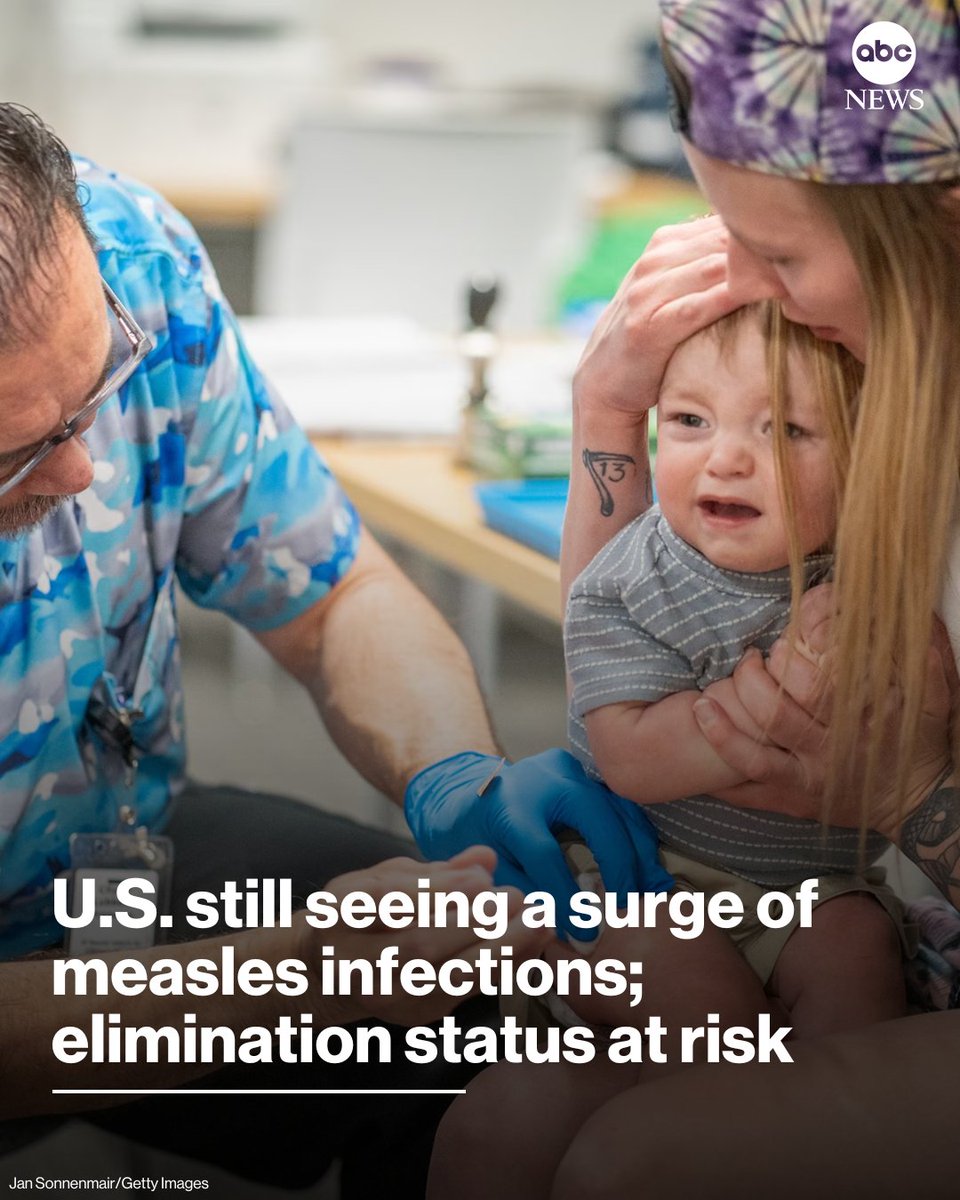 ABC's tweet image. One year ago, officials confirmed that cases of measles were cropping up in Texas.

If it's determined that the U.S. has experienced 12 months of continuous measles transmission, it could lead to a loss of the country's elimination status.

Read more: abcnews.link/rsFLRet